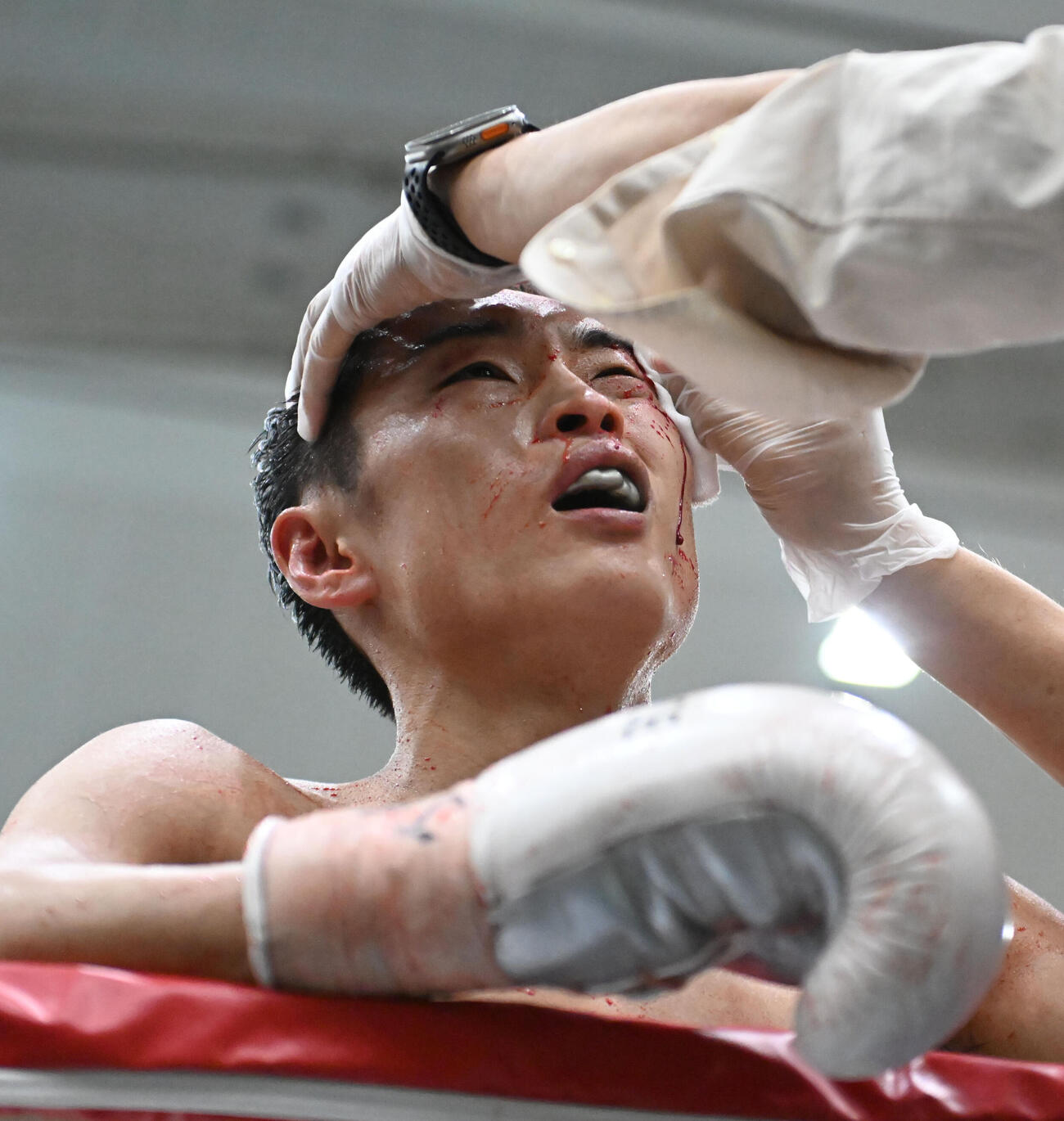 7回、左目上を裂傷し診察を受ける西田（撮影・和賀正仁）