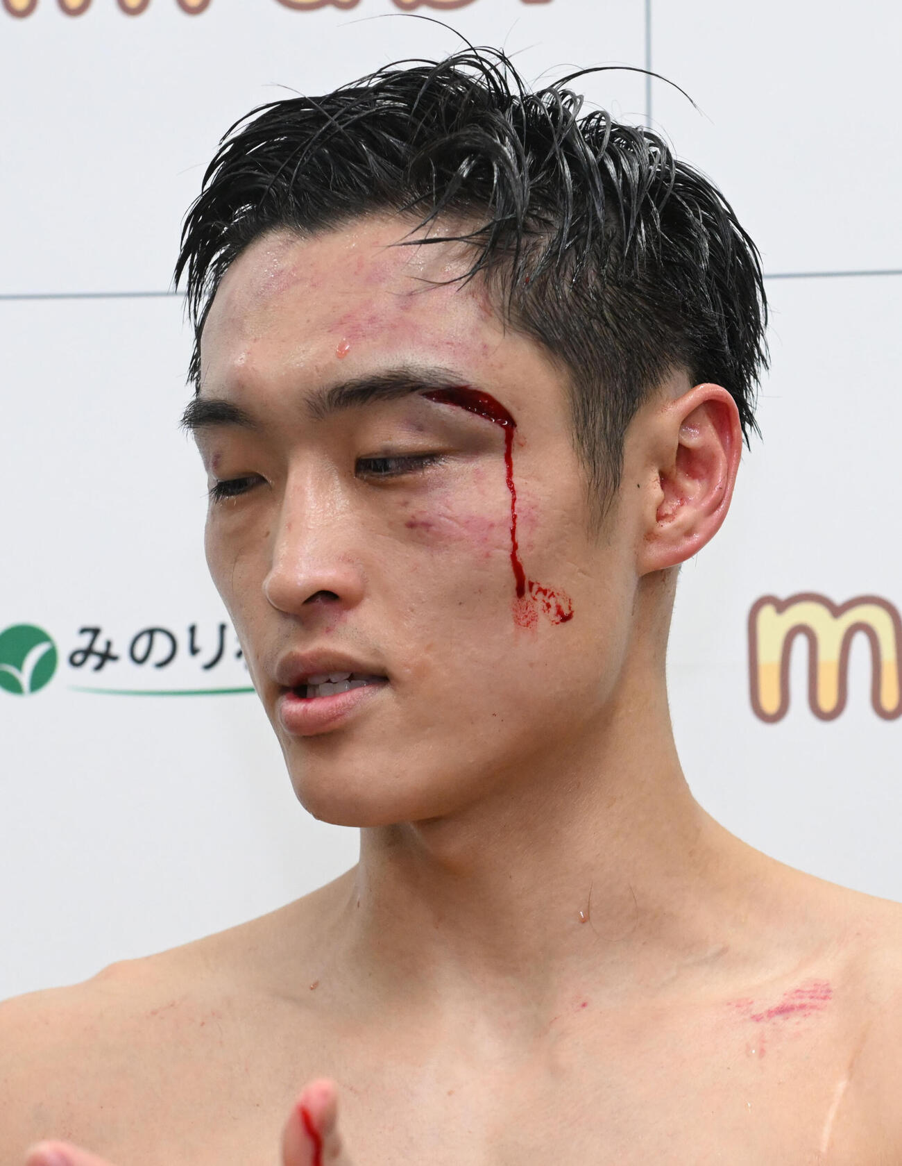 記者の取材を受けながらも流血が止まらない西田（撮影・和賀正仁）