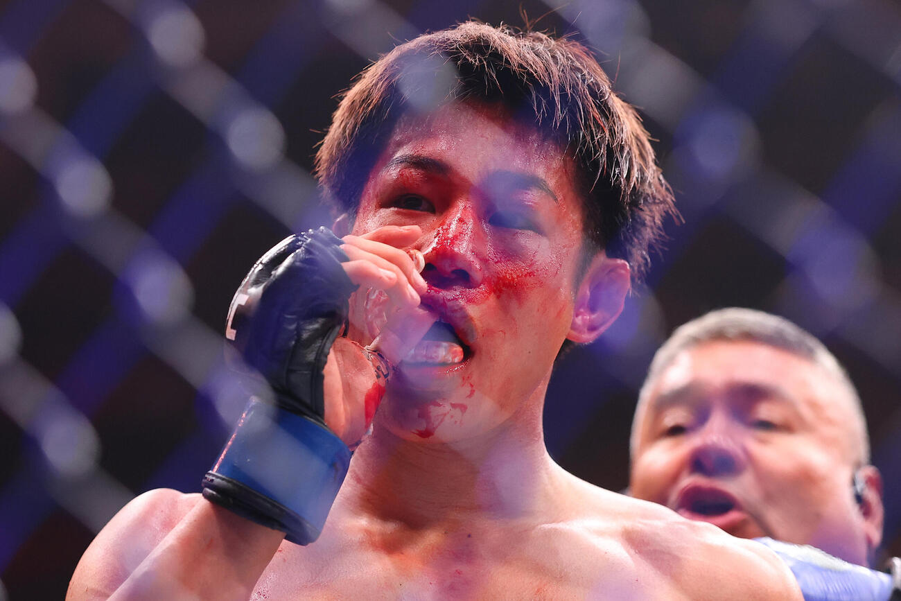 5回TKO負けを喫し、悔しそうな表情を浮かべるUFCフライ級3位平良達郎（C）ZuffaLLC／UFC