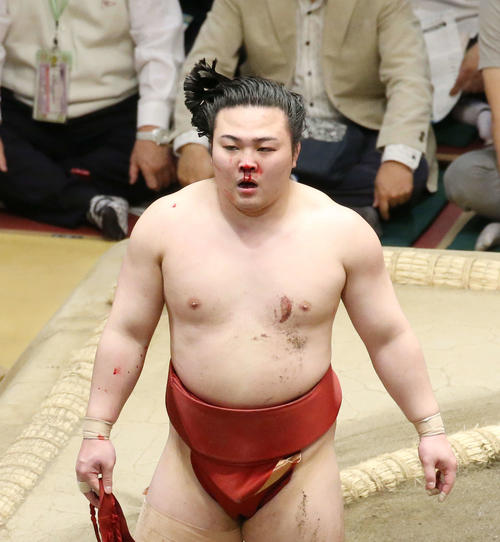 松鳳山との激しい取組の末、鼻から流血する炎鵬（撮影・河田真司）