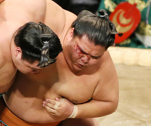 明生(左手前)との接触で流血する御嶽海(撮影・栗木一考)