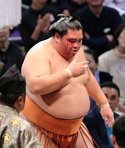 明生との取組で流血する御嶽海(撮影・鈴木正人)