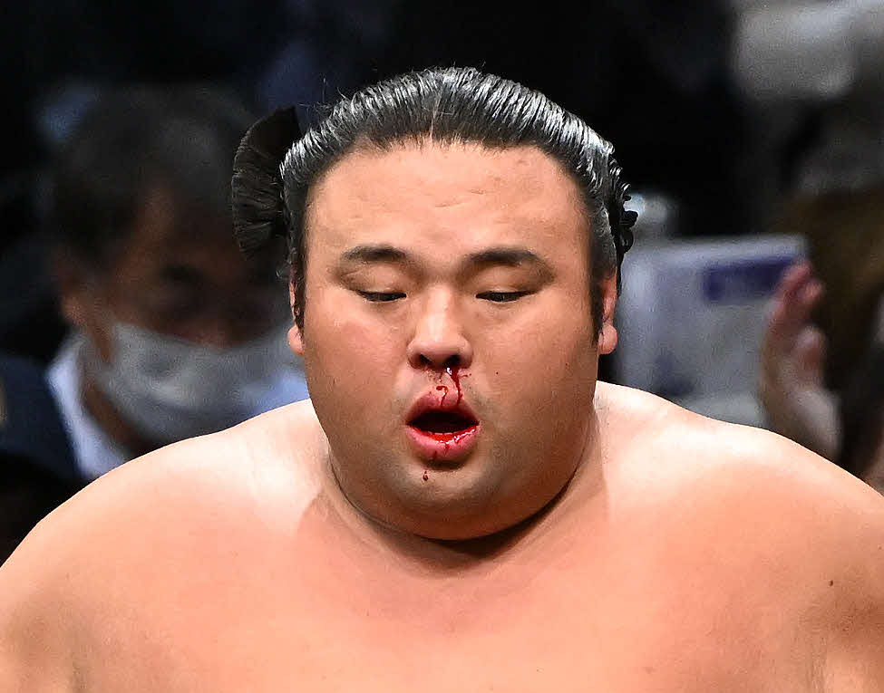 明生に敗れた貴景勝は鼻血を流す（撮影・滝沢徹郎）