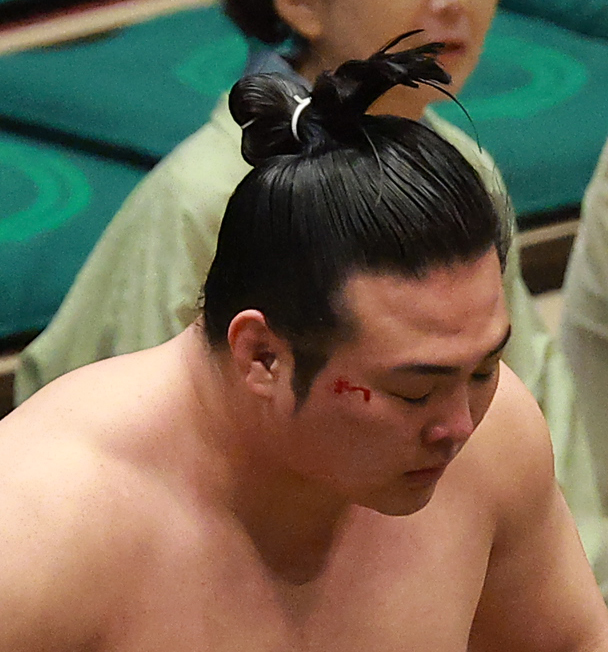 流血した炎鵬（撮影・中島郁夫）