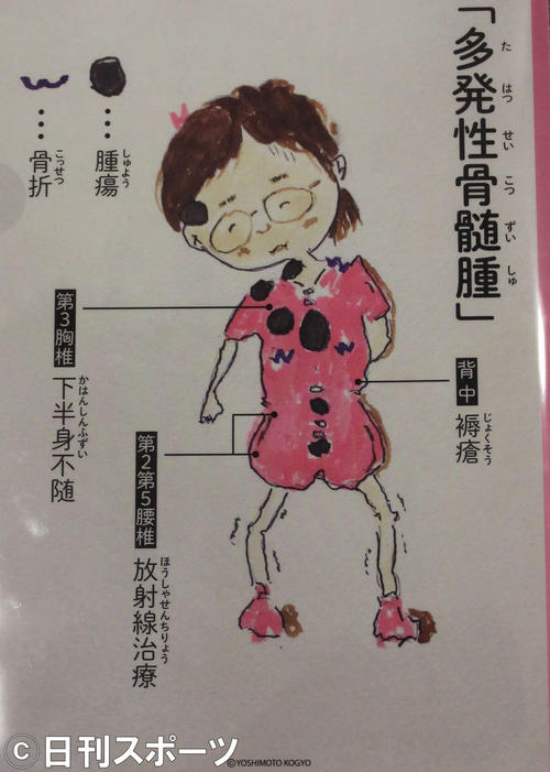 宮川花子が自ら描いた病状を説明するイラスト