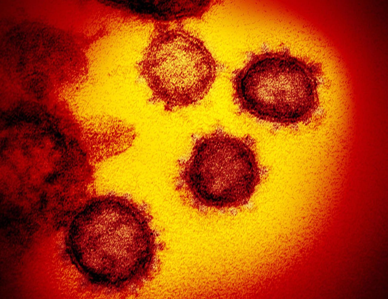 新型コロナウイルスの電子顕微鏡写真（米国立アレルギー感染症研究所提供）（共同）