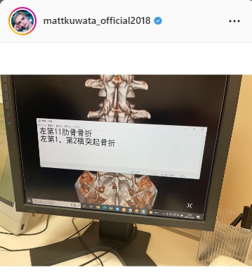 Mattインスタグラムより