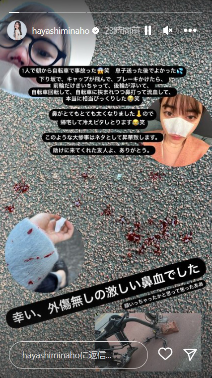 林みなほアナのインスタグラムのストーリーズより