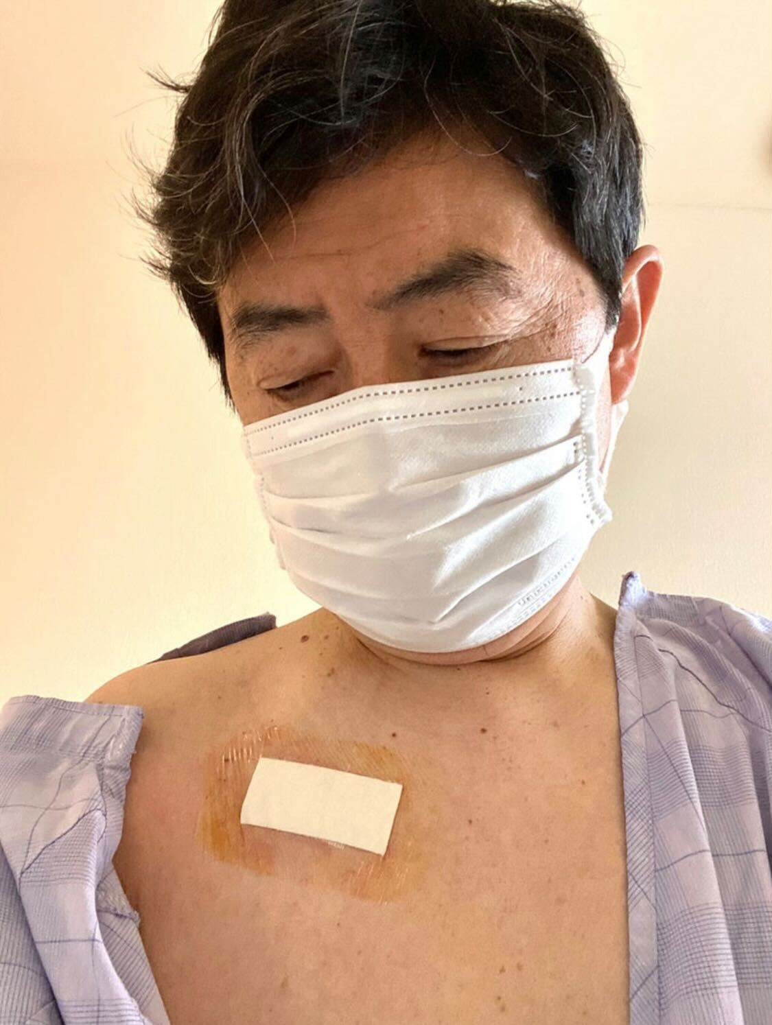 「CVポート抜去手術」を終えた笠井信輔アナ