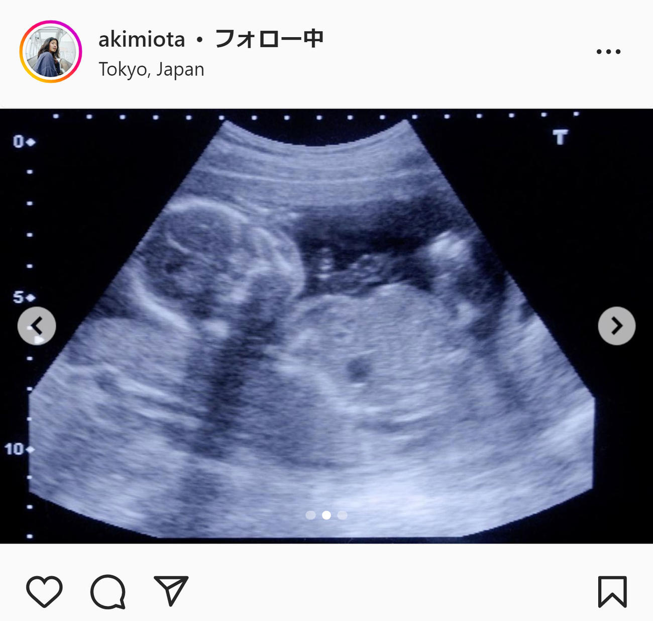 太田光海氏のインスタグラムより