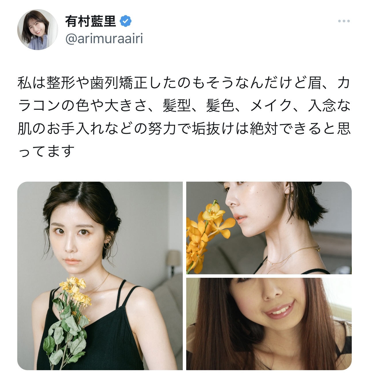 美容整形手術を受ける以前の写真をアップした有村藍里（有村藍里のTwitterから）
