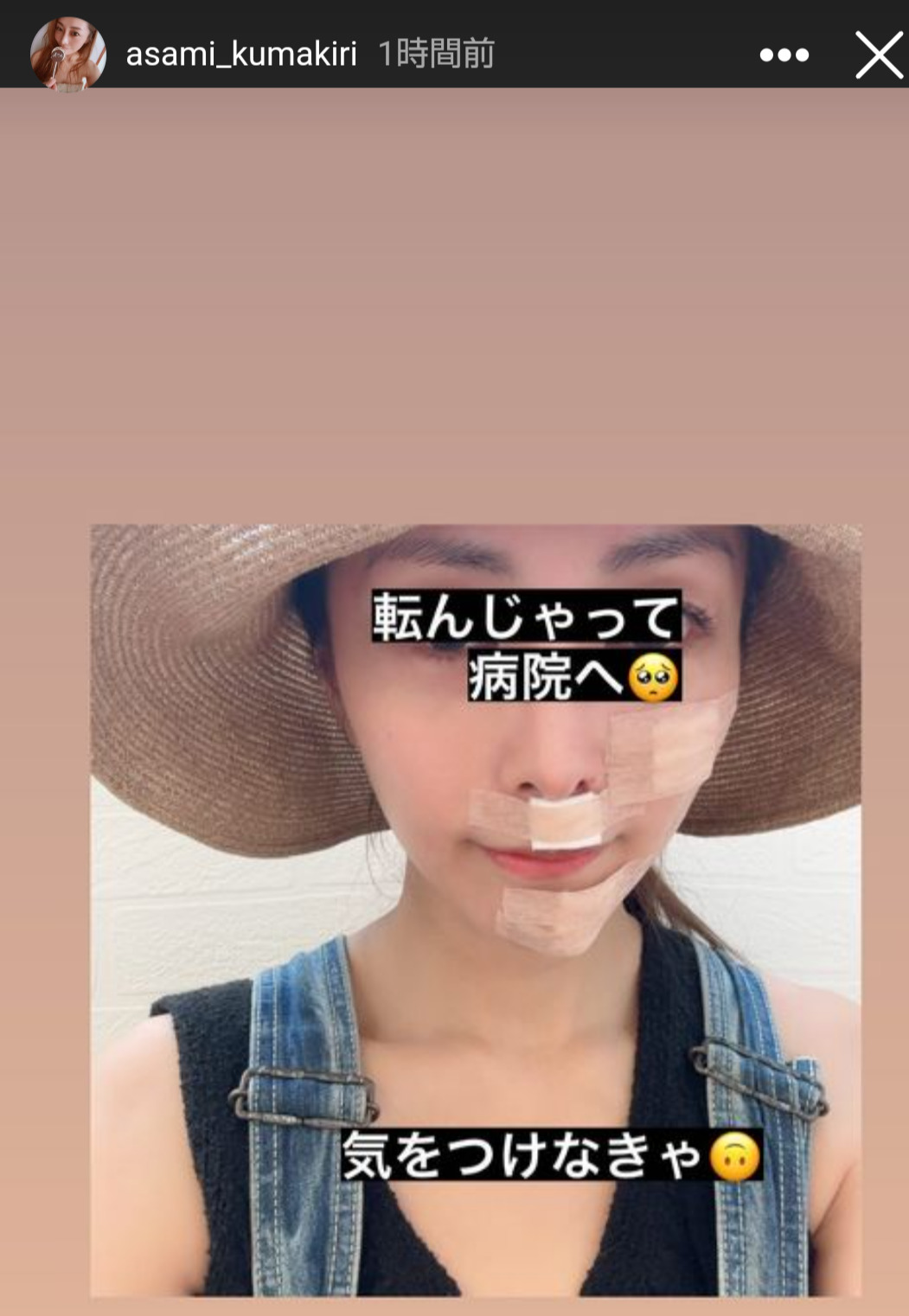 顔面を負傷した自身の姿を披露した熊切あさ美（熊切あさ美のインスタグラムから）