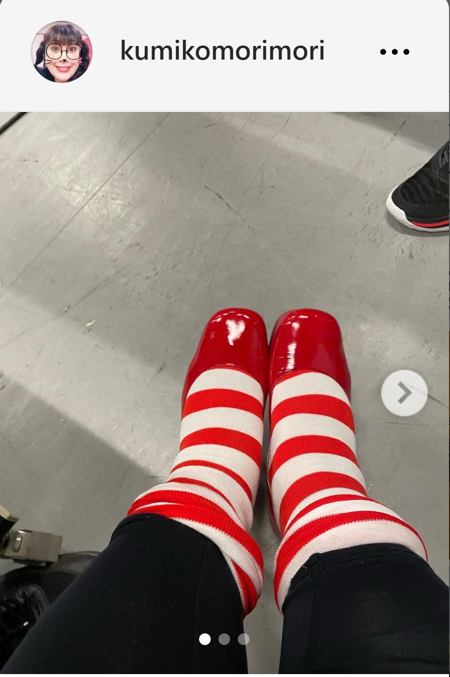森公美子が投稿した脚を写した“証拠写真”（森公美子のインスタグラムから）