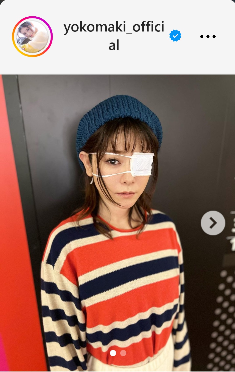 眼帯姿の真木よう子（真木よう子のインスタグラムから）