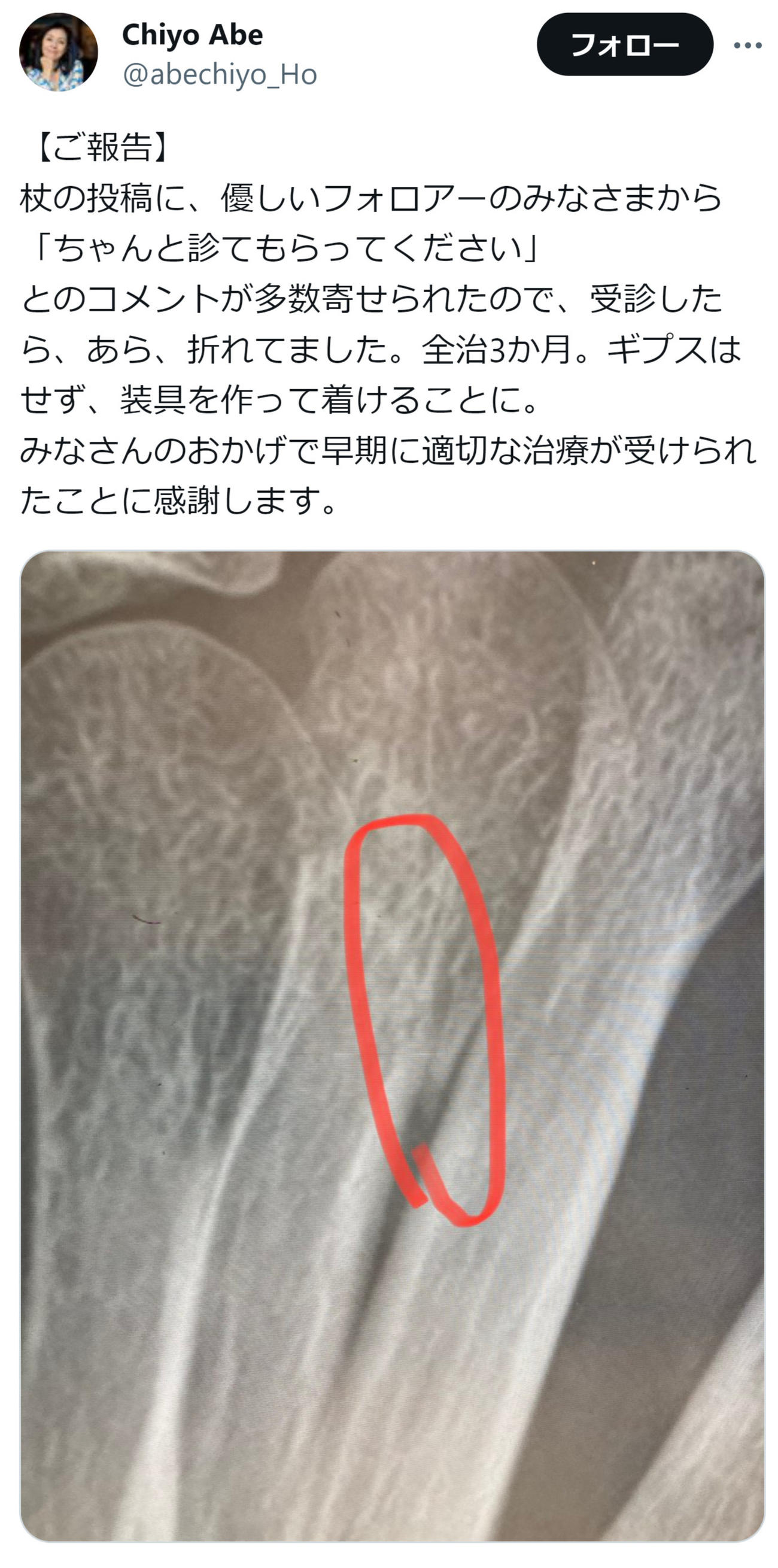 阿部知代氏のX（旧ツイッター）から