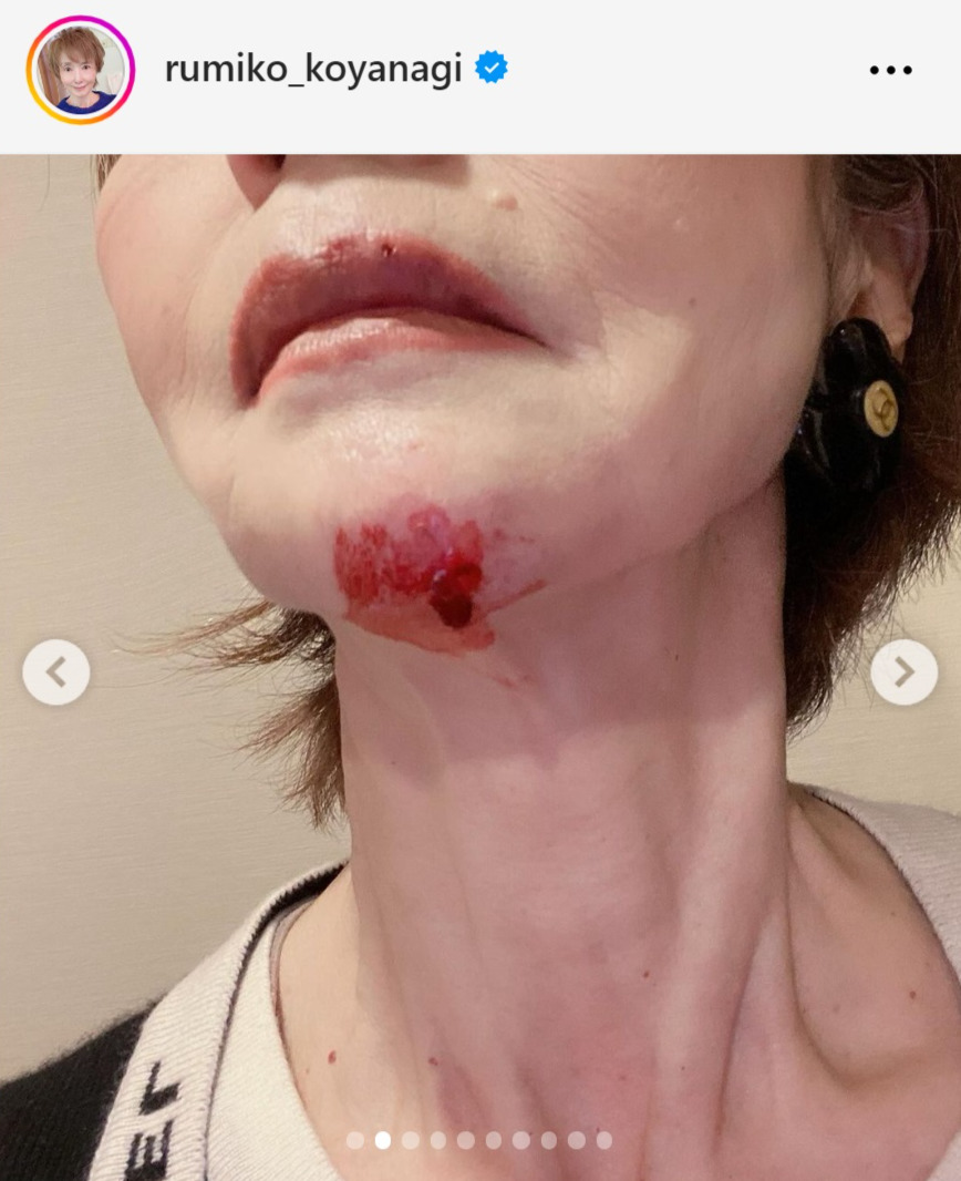 小柳ルミ子のインスタグラムから