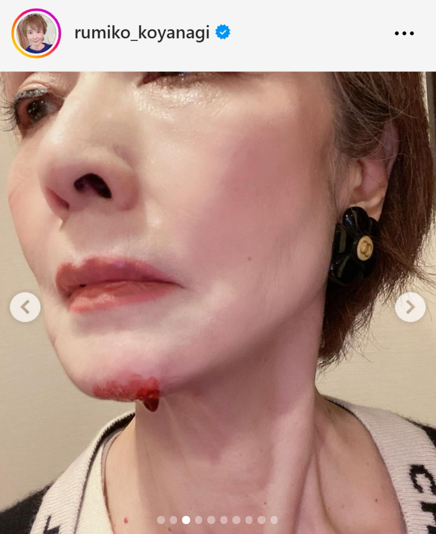小柳ルミ子のインスタグラムから