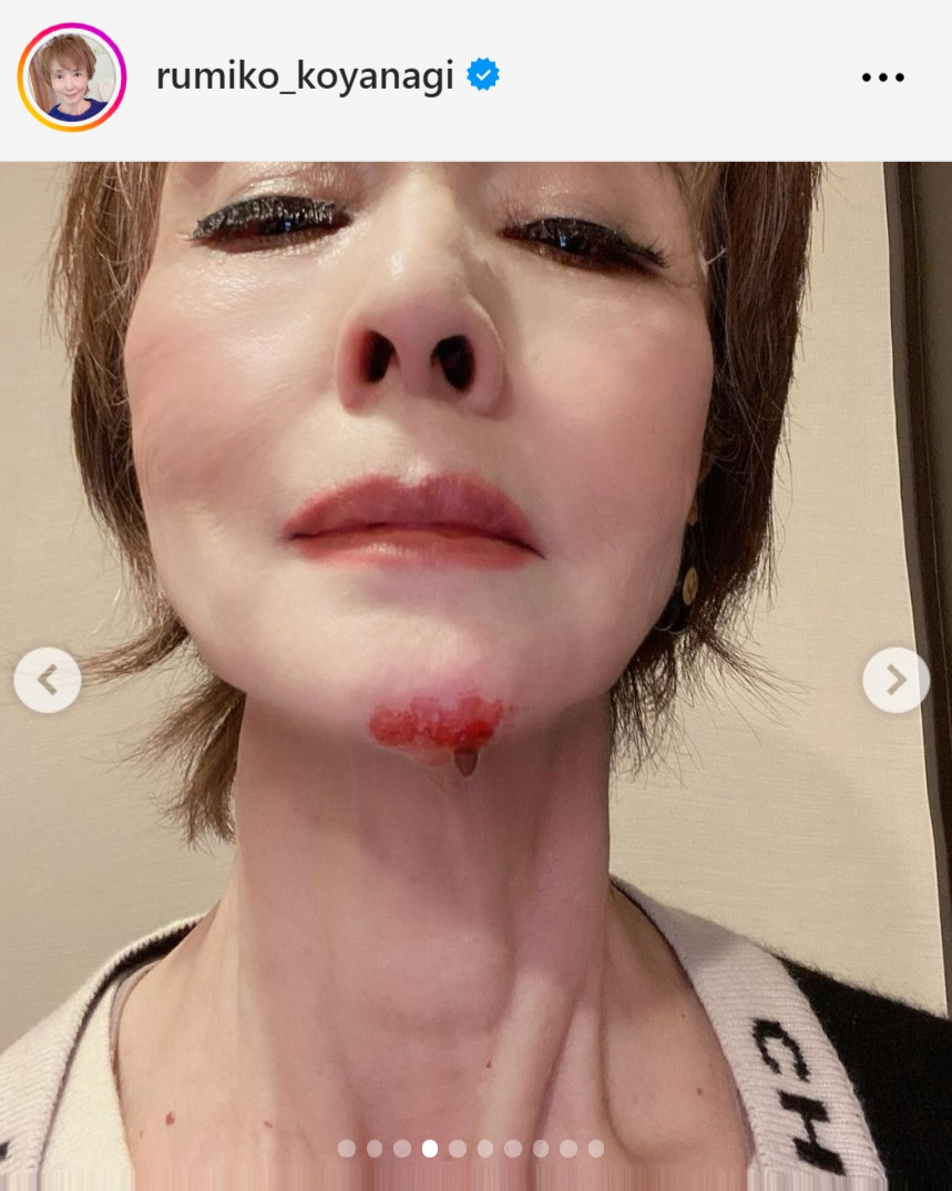 小柳ルミ子のインスタグラムから