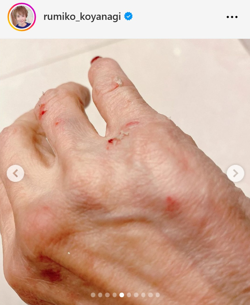 小柳ルミ子のインスタグラムから