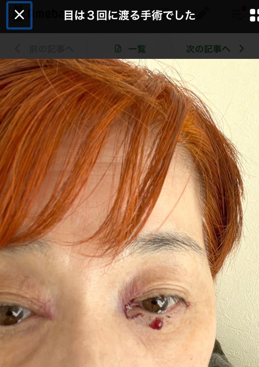 松居一代のブログから