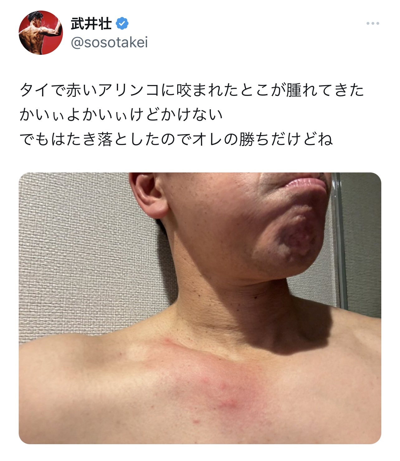 「タイで赤いアリンコに咬まれた」ことを報告した武井壮（武井壮のX（旧Twitter）から）