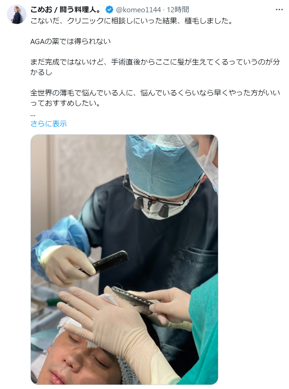 こめおのXから