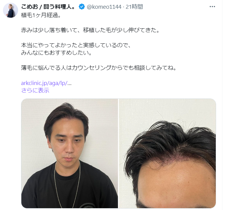 こめおのX（旧ツイッター）から