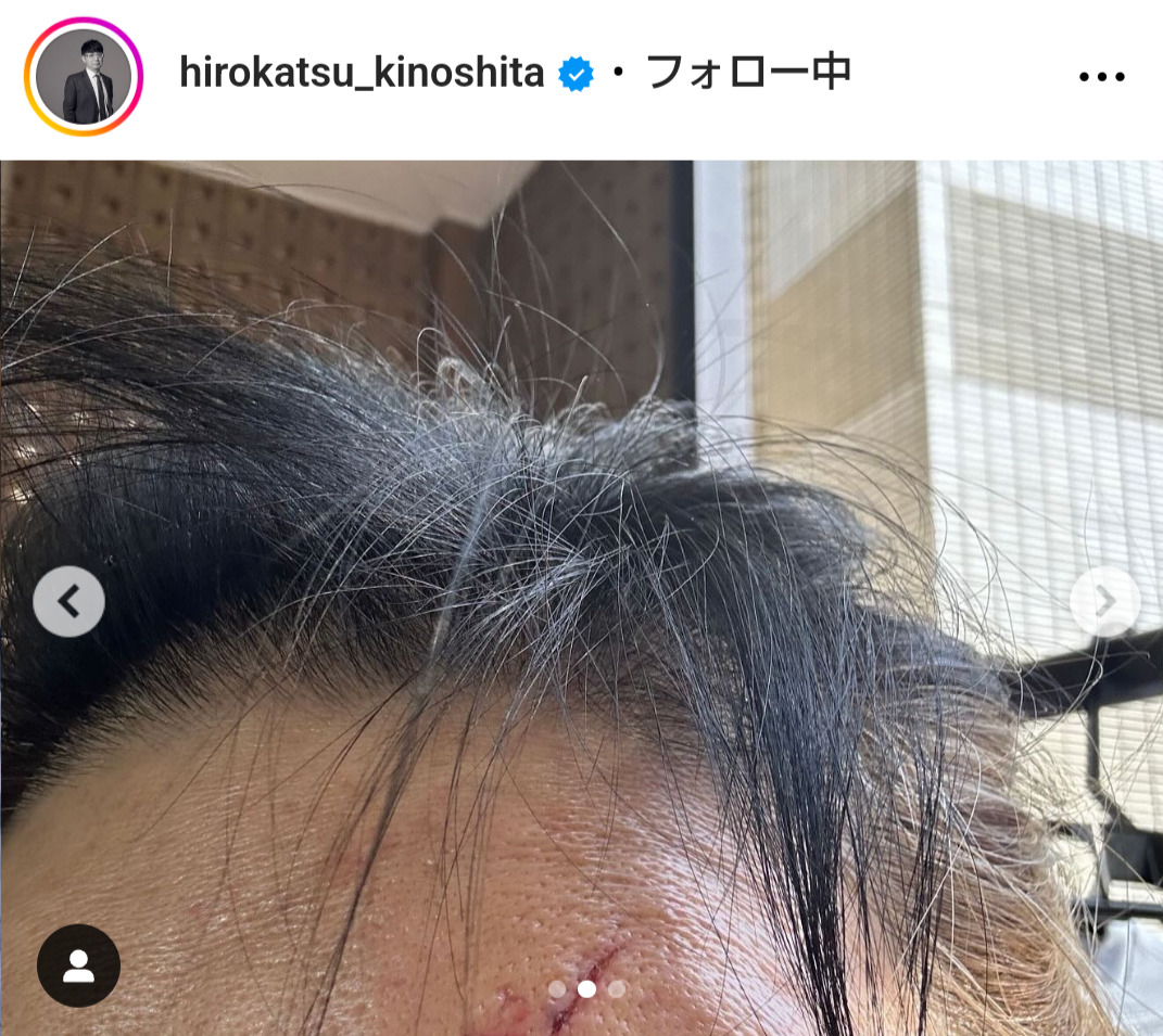 木下博勝氏のインスタグラムから