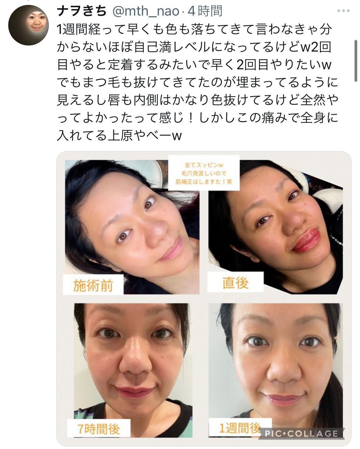 マキシマムザホルモン・ナヲのＸから