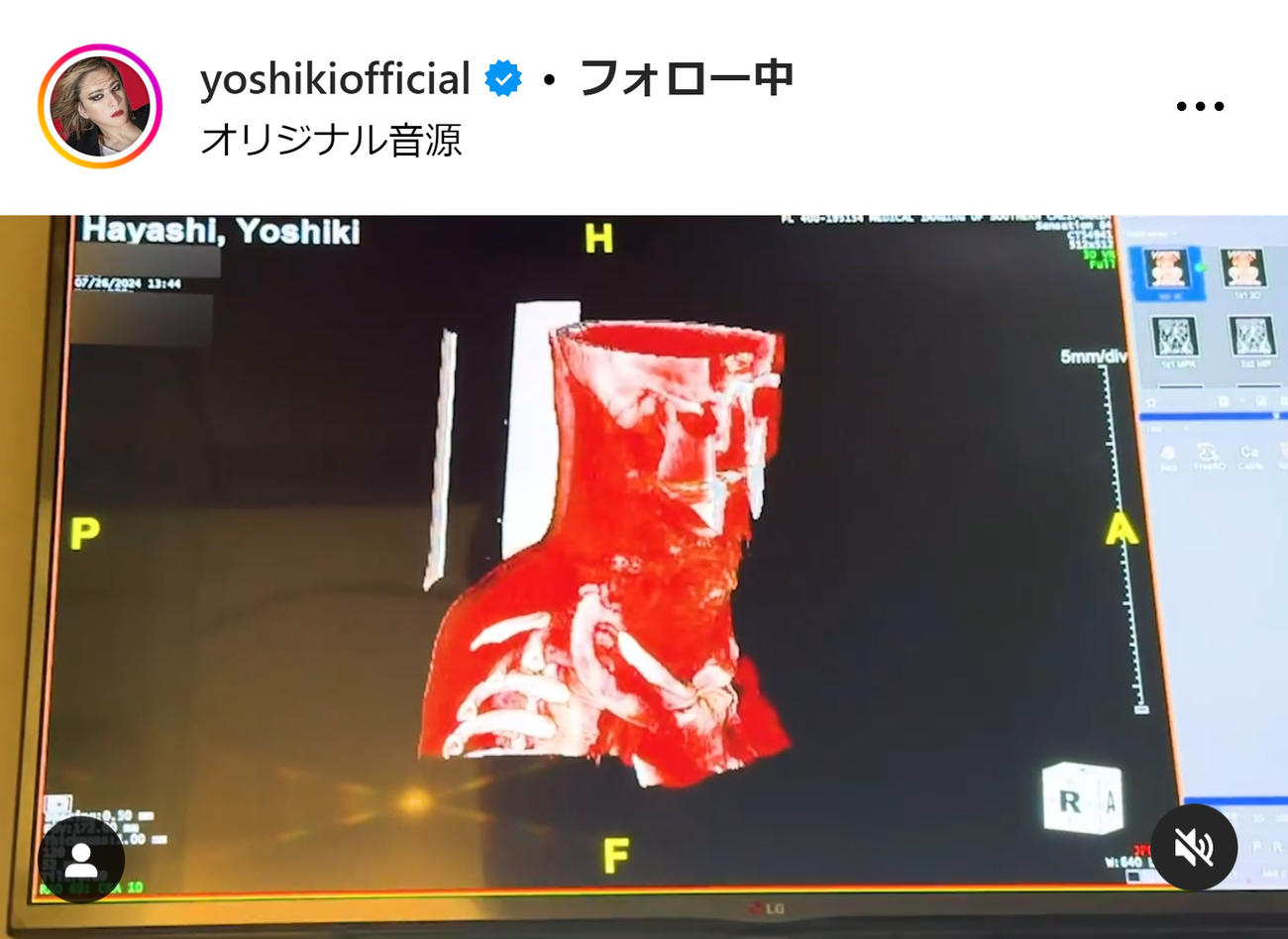 YOSHIKIのインスタグラムから