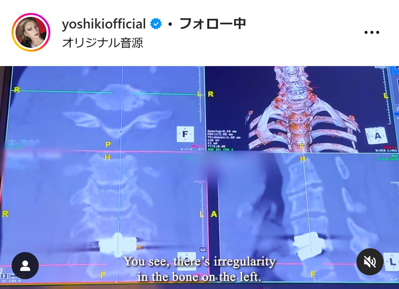 YOSHIKIのインスタグラムから
