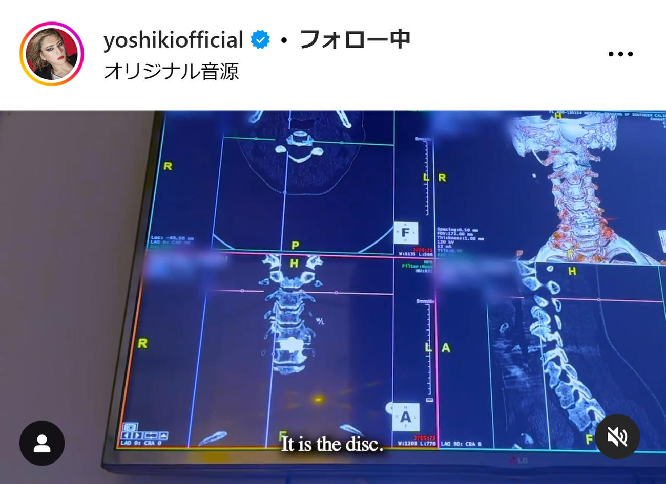 YOSHIKIのインスタグラムから