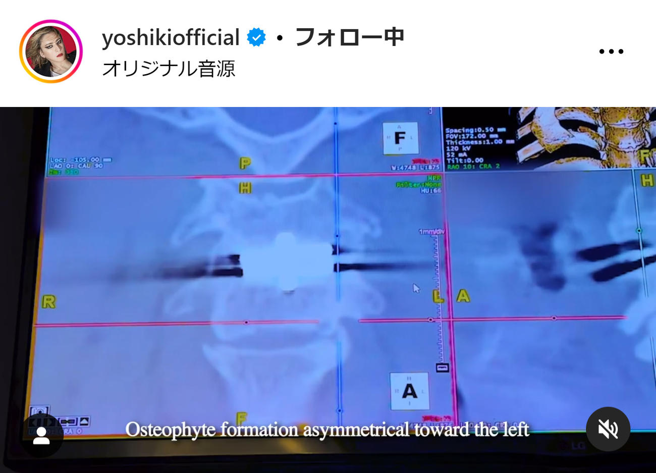 YOSHIKIのインスタグラムから