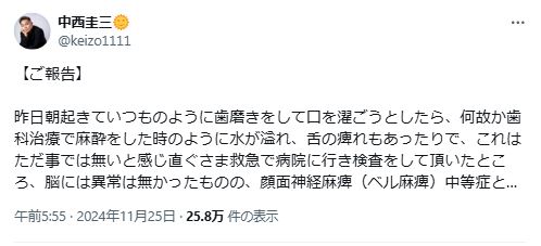 中西圭三のXから