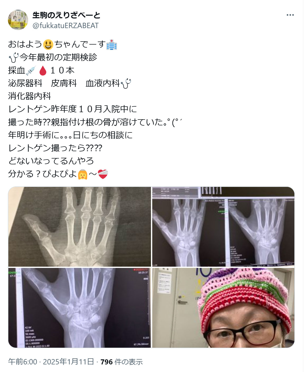 宮川花子のXから