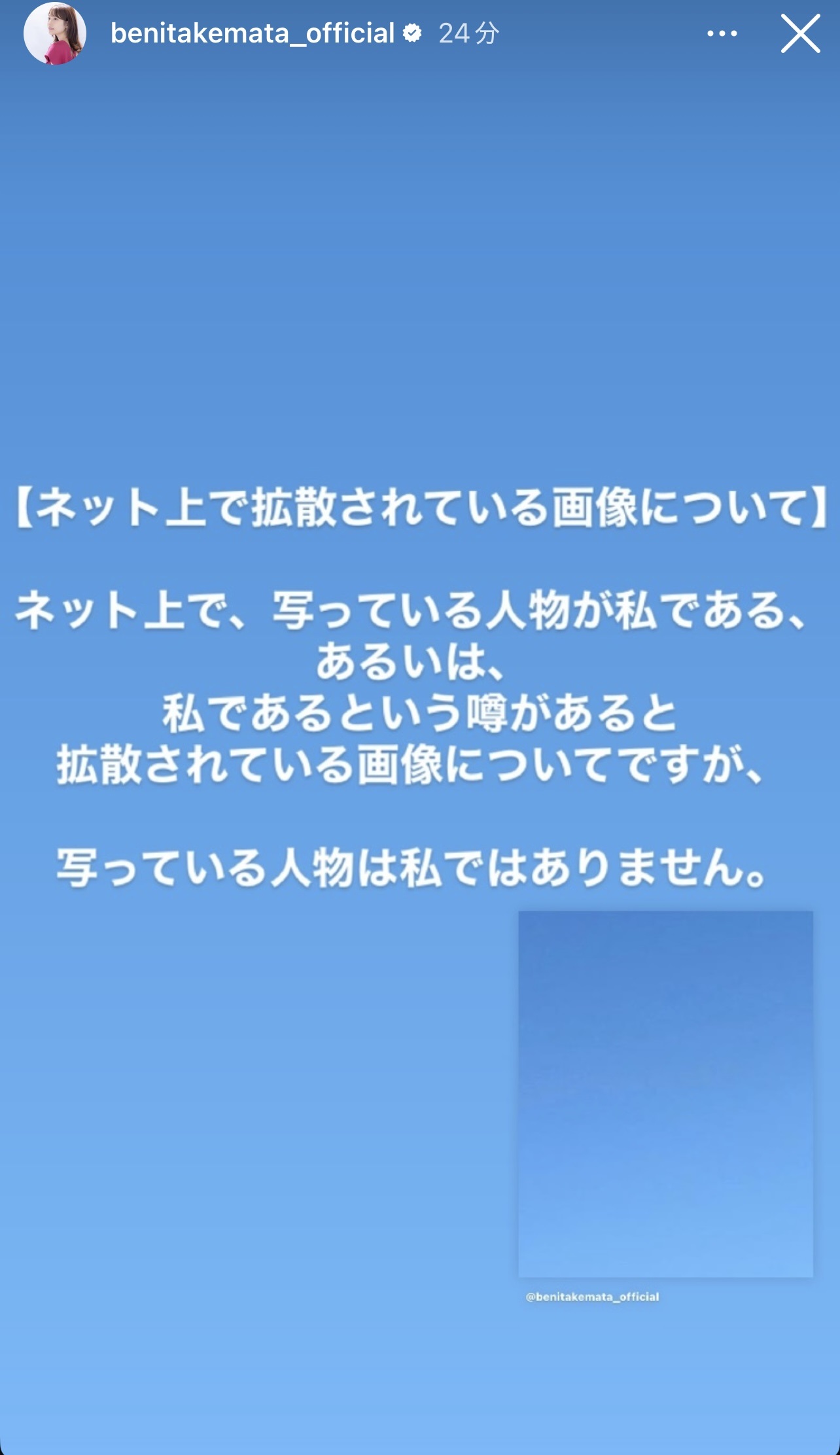 竹俣紅アナウンサーのストーリーズから