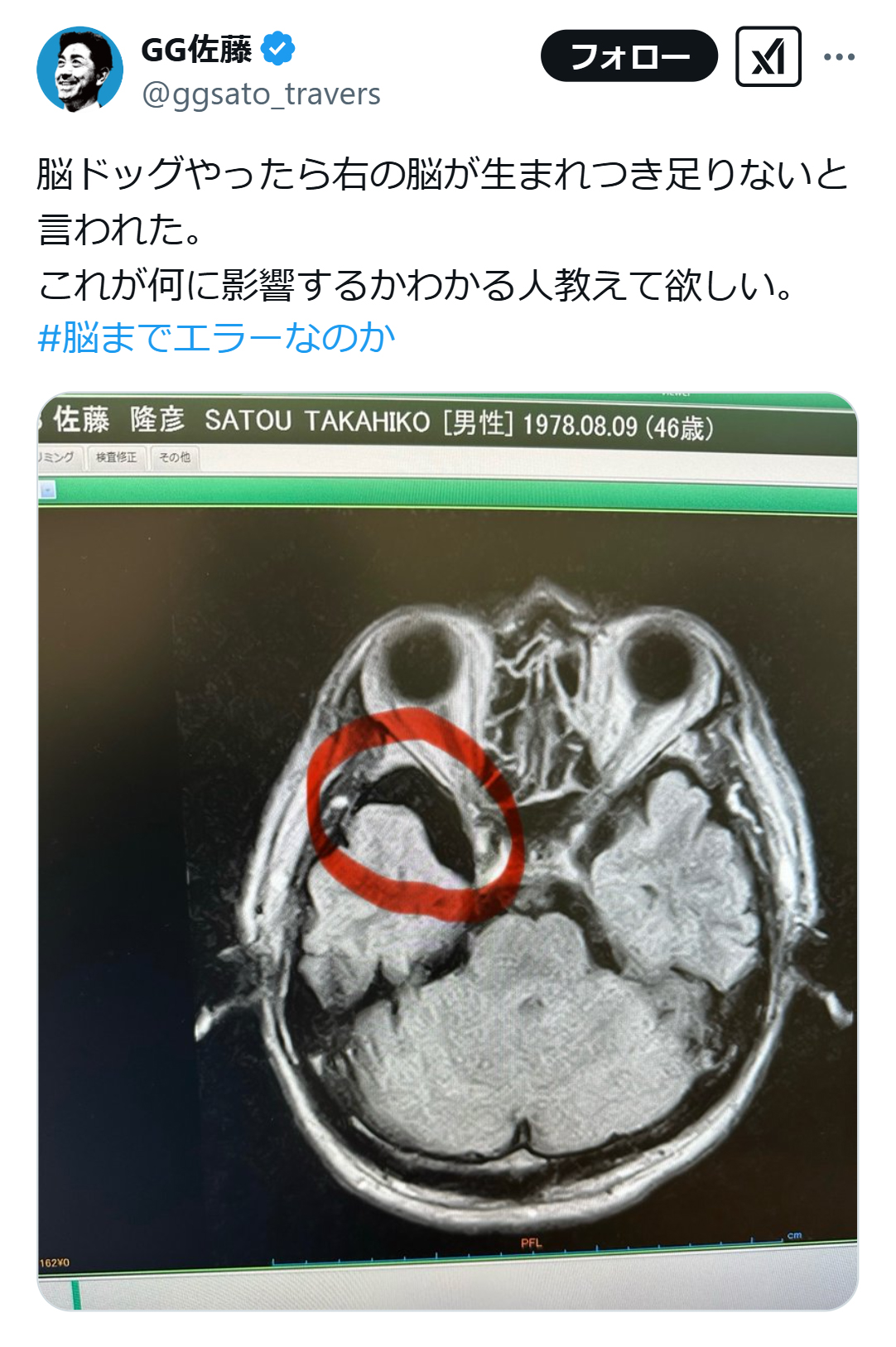 G.G.佐藤氏のX（旧ツイッター）から
