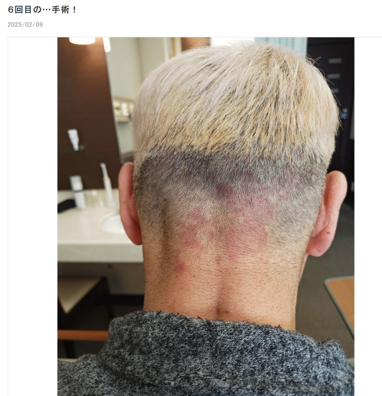 オール巨人のブログから