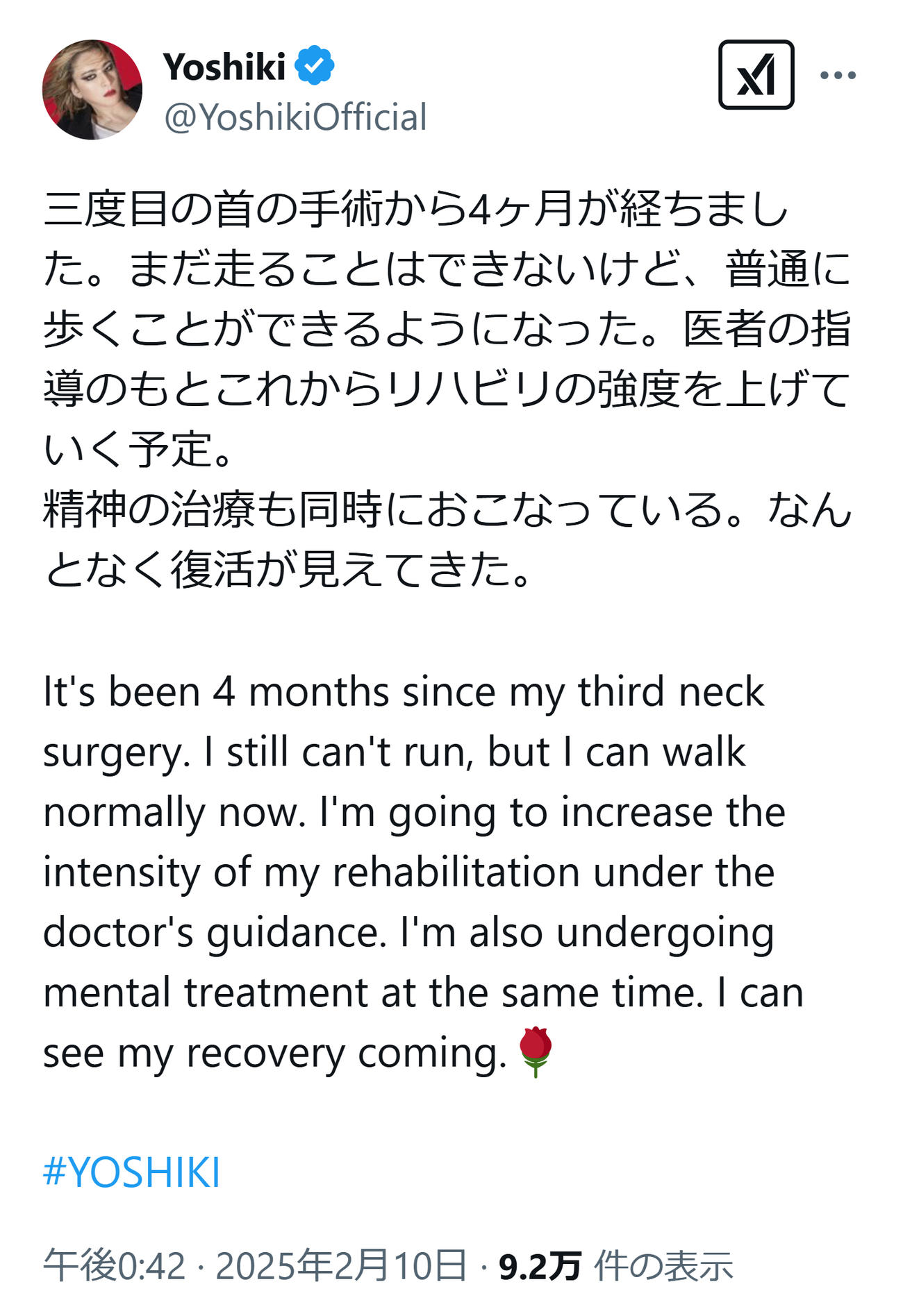 YOSHIKIのXから