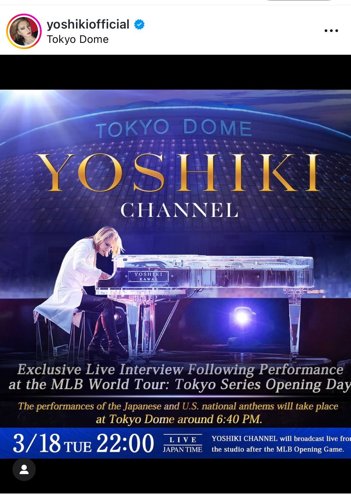YOSHIKIのインスタグラムから