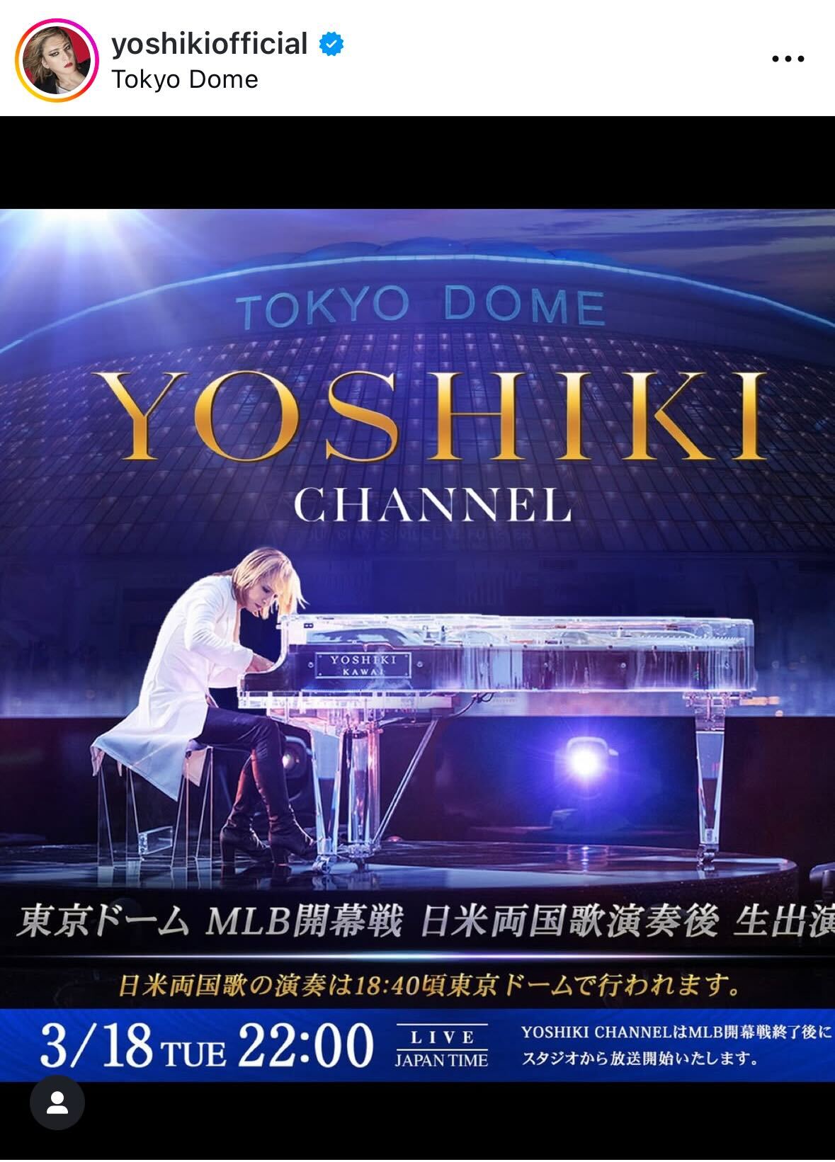 YOSHIKIのインスタグラムから