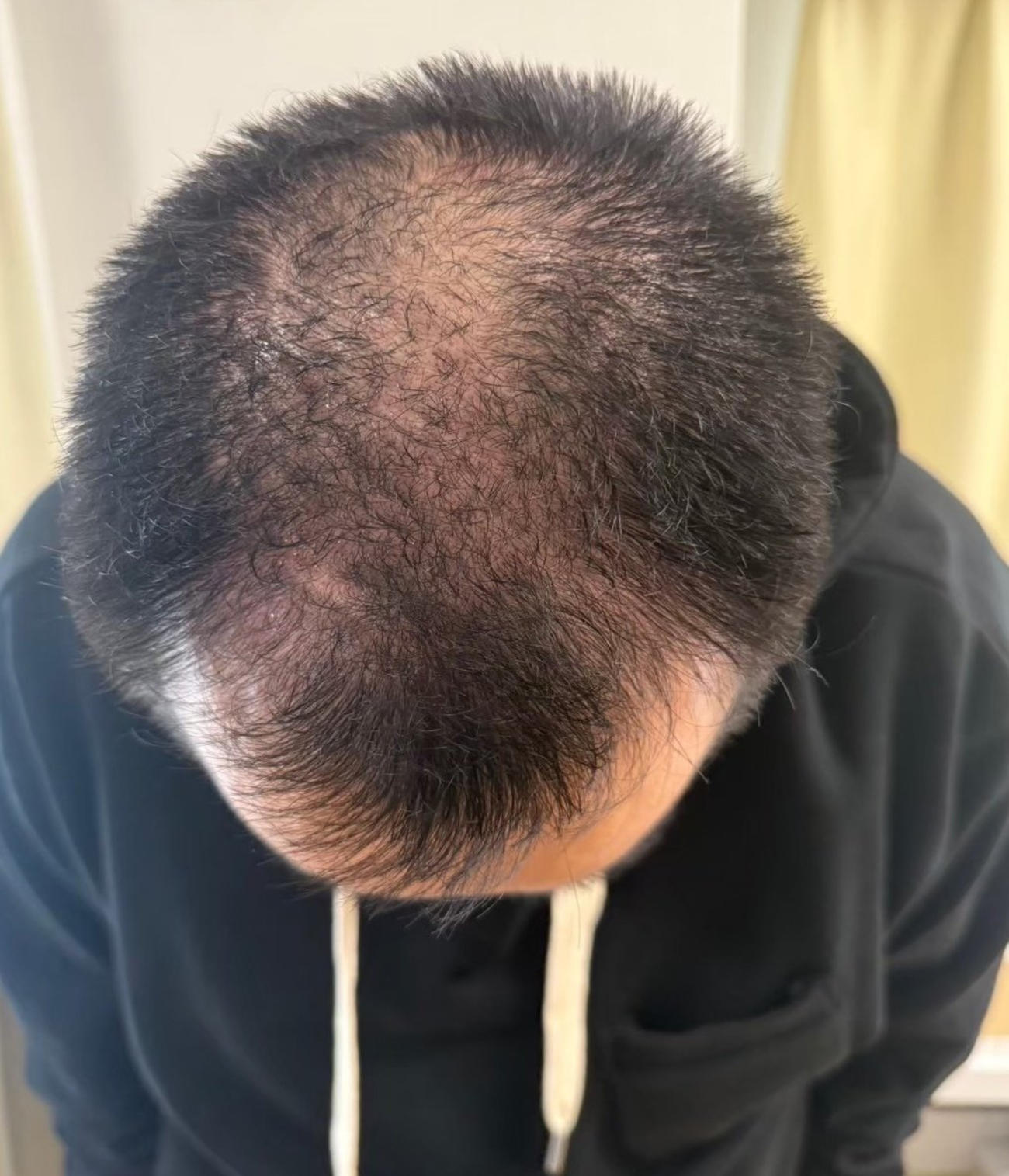 ミルクボーイ内海のXから