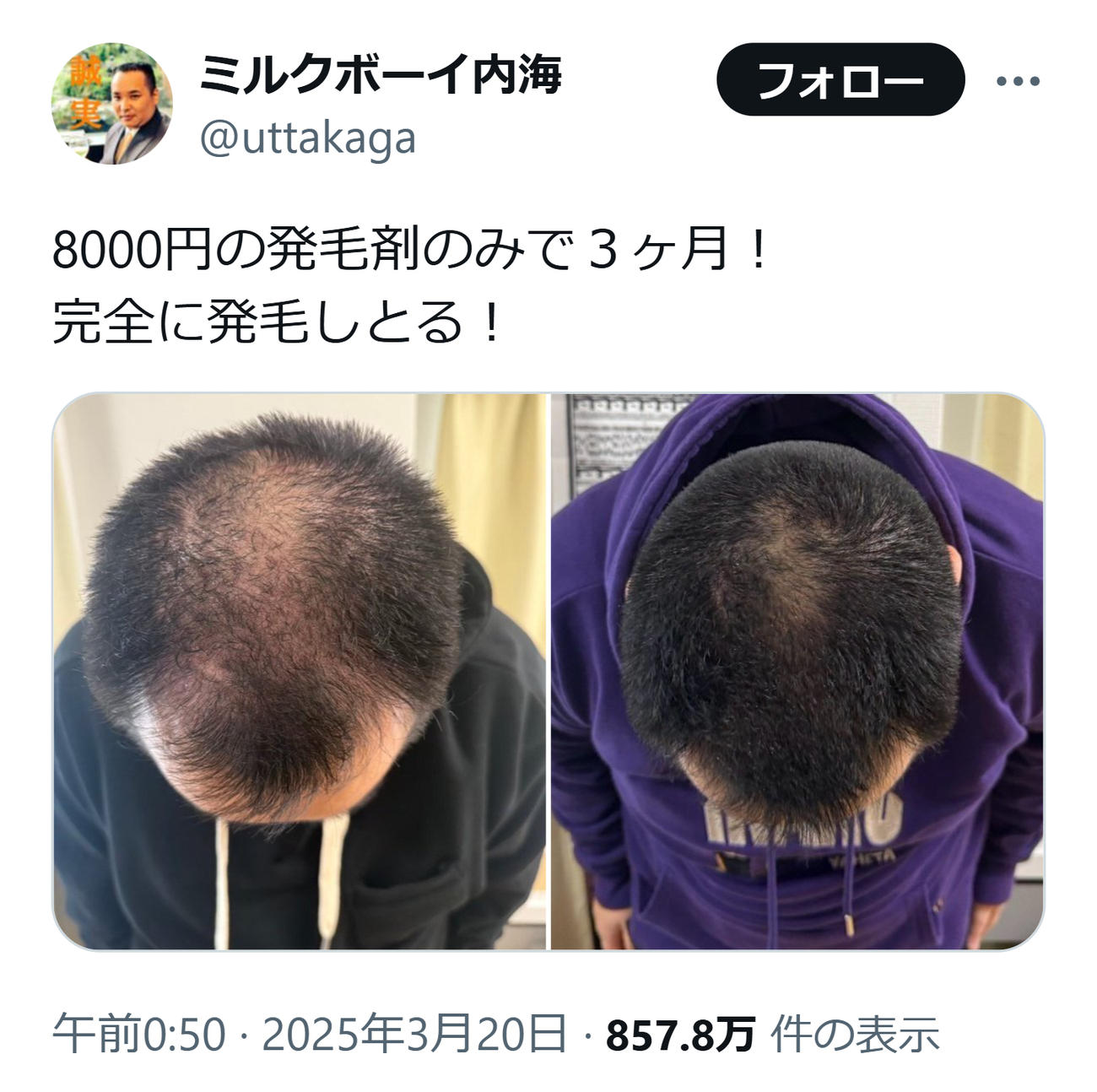 ミルクボーイ内海のXから