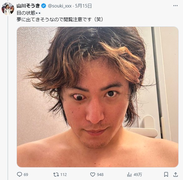 「目の状態　夢に出てきそうなので閲覧注意です（笑）」との注釈をつけ、現在の両目の状態の写真をＸに投稿した山川そうき
