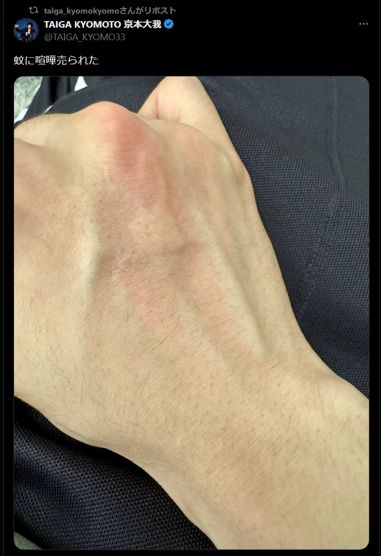 血管部分が赤く膨れ上がった手の甲