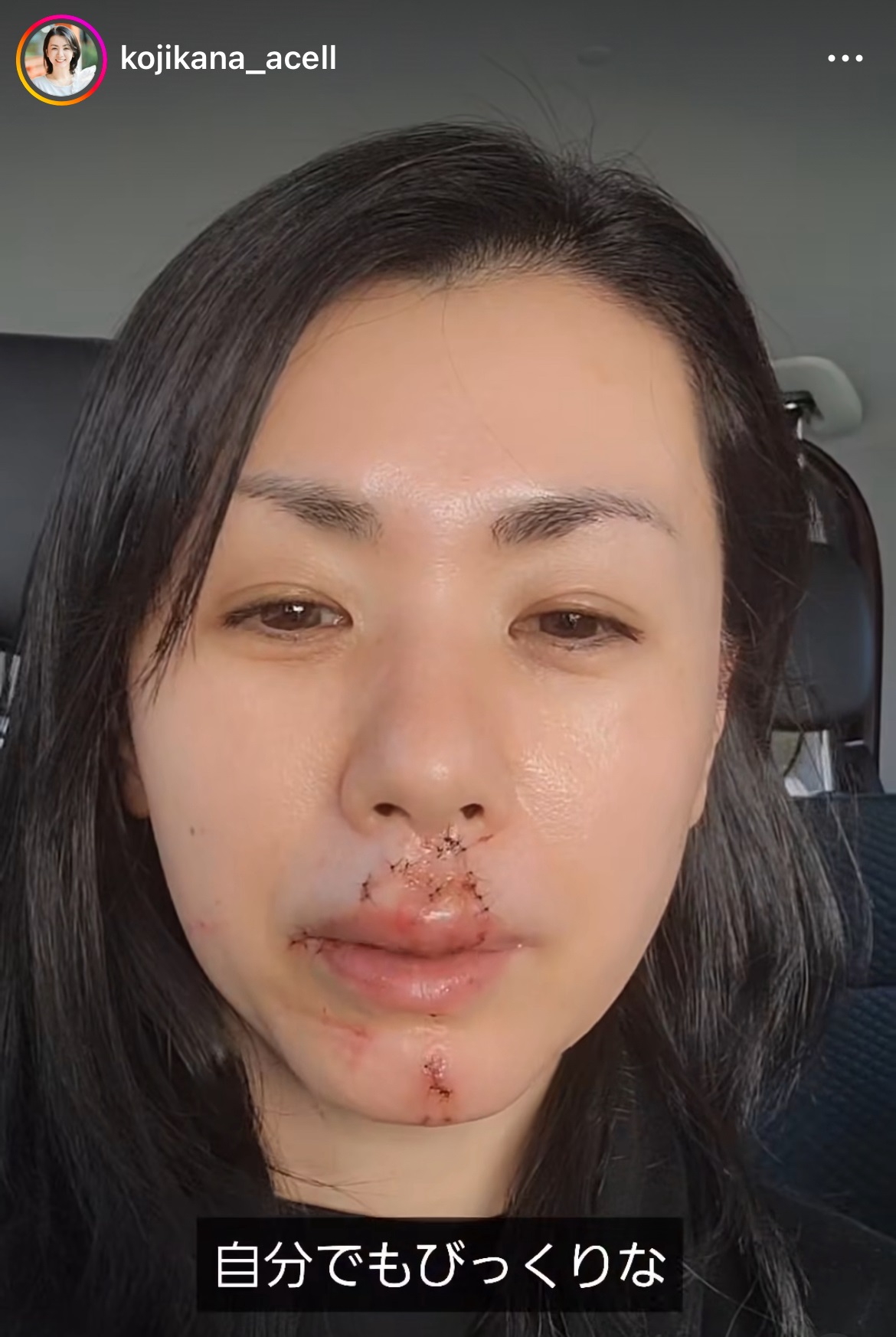 小島可奈子のインスタグラムから