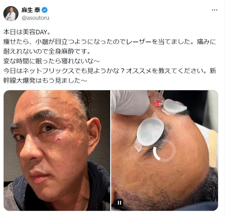 麻生泰氏のXから