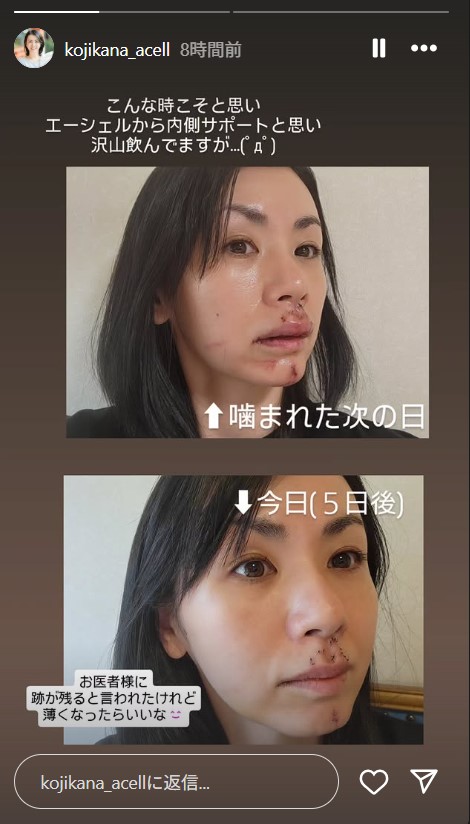 小島可奈子のインスタグラムから