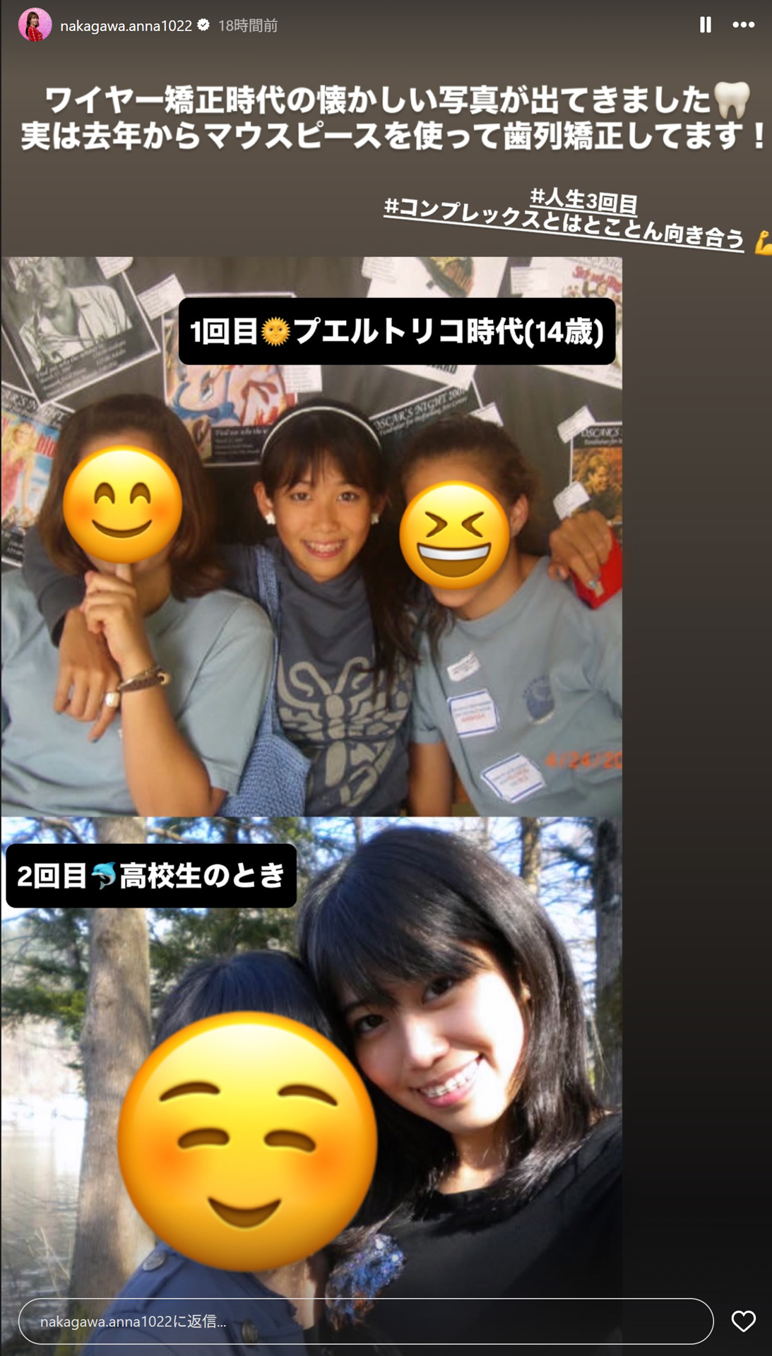 中学、高校時代のお宝ショット（中川安奈アナのストーリーズから）