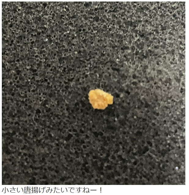 富澤たけしがブログに投稿した、体外に排出された尿路結石